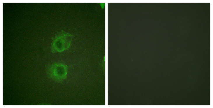 ERBB3 / HER3 Antibody - Immunofluorescence analysis of HUVEC cells, using HER3 Antibody. The picture on the right is blocked with the synthesized peptide.