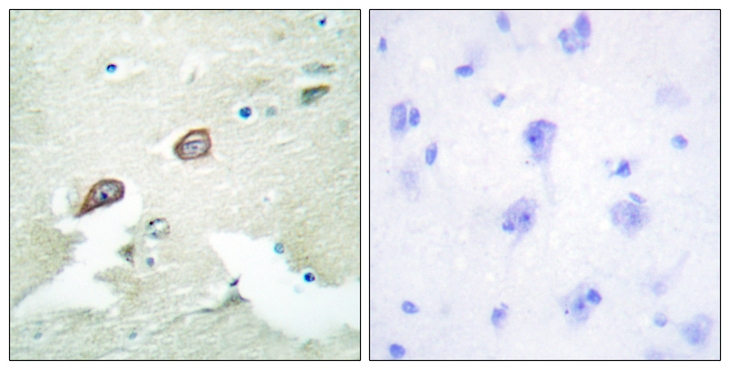 ERBB3 / HER3 Antibody - Immunohistochemistry analysis of paraffin-embedded human brain tissue, using HER3 Antibody. The picture on the right is blocked with the synthesized peptide.