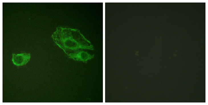 ERBB3 / HER3 Antibody - Immunofluorescence analysis of A549 cells, using HER3 Antibody. The picture on the right is blocked with the synthesized peptide.