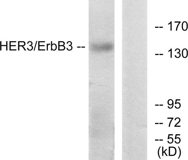 ERBB3 / HER3 Antibody - Western blot analysis of lysates from HeLa cells, using HER3 Antibody. The lane on the right is blocked with the synthesized peptide.