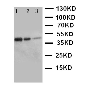 ERBB3 / HER3 Antibody - WB of HER3 / ERBB3 antibody. Recombinant Protein Detection Source:. E.coli derived -recombinant Human ERBB3, 45.0KD. (162aa tag+ M1-A245). Lane 1: Recombinant Human ERBB3 Protein 5ng. Lane 2: Recombinant Human ERBB3 Protein 2.5ng. Lane 3: Recombinant Human ERBB3 Protein 1.25ng.