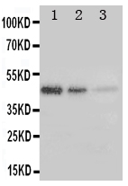ERBB3 / HER3 Antibody - Anti-ErbB 3 antibody, Western blottingRecombinant Protein Detection Source: E. coli derived -recombinant Human ERBB3, 45. 0KD (162aa tag+ M1-A245)Lane 1: Recombinant Human ERBB3 Protein 5ng Lane 2: Recombinant Human ERBB3 Protein 2. 5ng Lane 3: Recombinant Human ERBB3 Protein 1. 25ng
