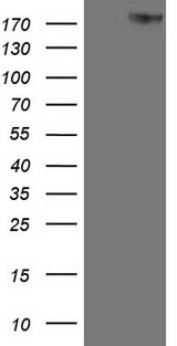 ERBB3 / HER3 Antibody - HEK293T cells were transfected with the pCMV6-ENTRY control. (Left lane) or pCMV6-ENTRY ERBB3. (Right lane) cDNA for 48 hrs and lysed. Equivalent amounts of cell lysates. (5 ug per lane) were separated by SDS-PAGE and immunoblotted with anti-ERBB3. (1:2000)