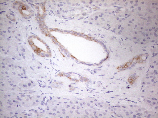 ERBB3 / HER3 Antibody - Immunohistochemical staining of paraffin-embedded Human pancreas tissue using anti-ERBB3 mouse monoclonal antibody. (Heat-induced epitope retrieval by 1mM EDTA in 10mM Tris buffer. (pH8.5) at 120°C for 3 min. (1:150)