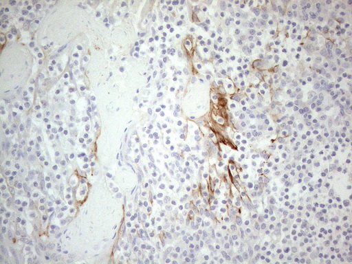 ERBB3 / HER3 Antibody - Immunohistochemical staining of paraffin-embedded Human tonsil using anti-ERBB3 mouse monoclonal antibody. (Heat-induced epitope retrieval by 1mM EDTA in 10mM Tris buffer. (pH8.5) at 120°C for 3 min. (1:150)