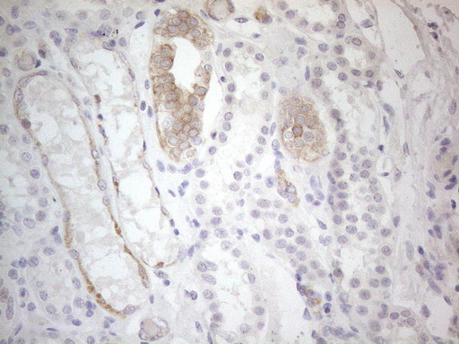 ERBB3 / HER3 Antibody - Immunohistochemical staining of paraffin-embedded Human Kidney tissue using anti-ERBB3 mouse monoclonal antibody. (Heat-induced epitope retrieval by 1mM EDTA in 10mM Tris buffer. (pH8.5) at 120°C for 3 min. (1:150)