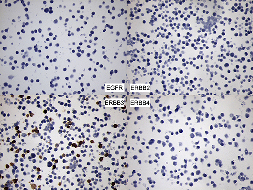 ERBB3 / HER3 Antibody - Immunohistochemical staining of paraffin-embedded 293T transfected with EGFR, ERBB2, ERBB3 and ERBB4 using anti-ERBB3 mouse monoclonal antibody. (Heat-induced epitope retrieval by 1mM EDTA in 10mM Tris buffer. (pH8.5) at 120°C for 3 min. (1:500)