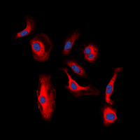 ERBB3 / HER3 Antibody - Immunofluorescent analysis of HER3 (pY1328) staining in MCF7 cells. Formalin-fixed cells were permeabilized with 0.1% Triton X-100 in TBS for 5-10 minutes and blocked with 3% BSA-PBS for 30 minutes at room temperature. Cells were probed with the primary antibody in 3% BSA-PBS and incubated overnight at 4 deg C in a humidified chamber. Cells were washed with PBST and incubated with a DyLight 594-conjugated secondary antibody (red) in PBS at room temperature in the dark. DAPI was used to stain the cell nuclei (blue).