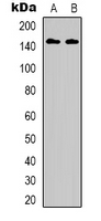 ERBB3 / HER3 Antibody - Western blot analysis of HER3 (pY1222) expression in A431 EGF-treated (A); MCF7 EGF-treated (B) whole cell lysates.