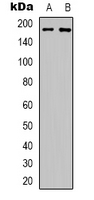 ERBB3 / HER3 Antibody - Western blot analysis of HER3 (pY1289) expression in MCF7 (A); K562 (B) whole cell lysates.