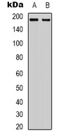 ERBB3 / HER3 Antibody - Western blot analysis of HER3 expression in HEK293T (A); HeLa (B) whole cell lysates.