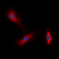 ERBB3 / HER3 Antibody - Immunofluorescent analysis of HER3 staining in A549 cells. Formalin-fixed cells were permeabilized with 0.1% Triton X-100 in TBS for 5-10 minutes and blocked with 3% BSA-PBS for 30 minutes at room temperature. Cells were probed with the primary antibody in 3% BSA-PBS and incubated overnight at 4 deg C in a humidified chamber. Cells were washed with PBST and incubated with a DyLight 594-conjugated secondary antibody (red) in PBS at room temperature in the dark. DAPI was used to stain the cell nuclei (blue).
