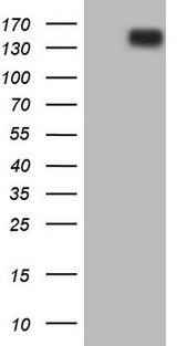ERBB3 / HER3 Antibody - HEK293T cells were transfected with the pCMV6-ENTRY control (Left lane) or pCMV6-ENTRY ERBB3 (Right lane) cDNA for 48 hrs and lysed. Equivalent amounts of cell lysates (5 ug per lane) were separated by SDS-PAGE and immunoblotted with anti-ERBB3.