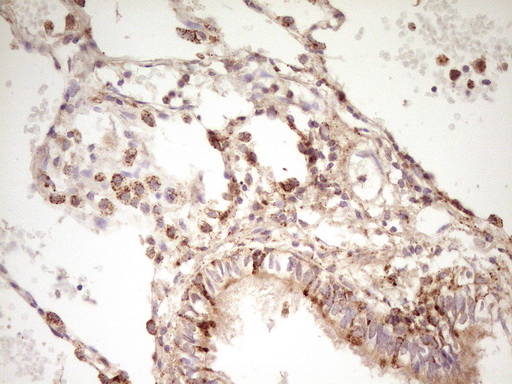 ERBB3 / HER3 Antibody - IHC of paraffin-embedded Human lung tissue using anti-ERBB3 mouse monoclonal antibody. (Heat-induced epitope retrieval by 1 mM EDTA in 10mM Tris, pH8.5, 120°C for 3min).