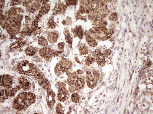ERBB3 / HER3 Antibody - IHC of paraffin-embedded Human pancreas tissue using anti-ERBB3 mouse monoclonal antibody. (Heat-induced epitope retrieval by 1 mM EDTA in 10mM Tris, pH8.5, 120°C for 3min).