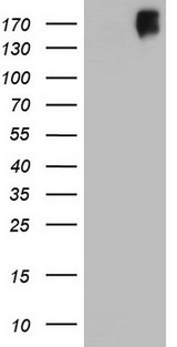 ERBB3 / HER3 Antibody - HEK293T cells were transfected with the pCMV6-ENTRY control (Left lane) or pCMV6-ENTRY ERBB3 (Right lane) cDNA for 48 hrs and lysed. Equivalent amounts of cell lysates (5 ug per lane) were separated by SDS-PAGE and immunoblotted with anti-ERBB3.
