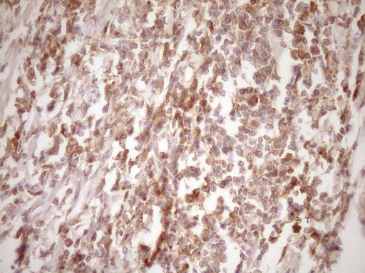 ERBB3 / HER3 Antibody - IHC of paraffin-embedded Human colon tissue using anti-ERBB3 mouse monoclonal antibody. (Heat-induced epitope retrieval by 1 mM EDTA in 10mM Tris, pH8.5, 120°C for 3min).