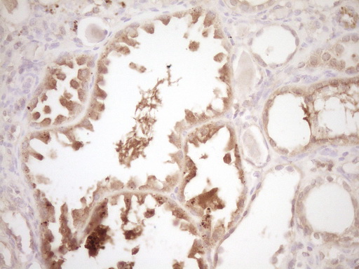 ERBB3 / HER3 Antibody - IHC of paraffin-embedded Human Kidney tissue using anti-ERBB3 mouse monoclonal antibody. (Heat-induced epitope retrieval by 1 mM EDTA in 10mM Tris, pH8.5, 120°C for 3min).