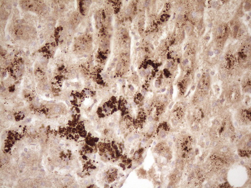 ERBB3 / HER3 Antibody - IHC of paraffin-embedded Human liver tissue using anti-ERBB3 mouse monoclonal antibody. (Heat-induced epitope retrieval by 1 mM EDTA in 10mM Tris, pH8.5, 120°C for 3min).