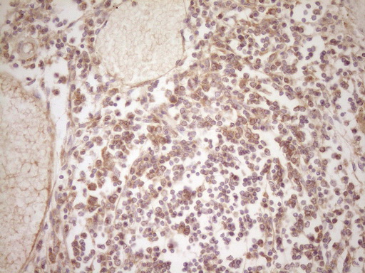 ERBB3 / HER3 Antibody - IHC of paraffin-embedded Human thyroid tissue using anti-ERBB3 mouse monoclonal antibody. (Heat-induced epitope retrieval by 1 mM EDTA in 10mM Tris, pH8.5, 120°C for 3min).