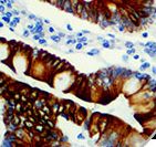 ERBB3 / HER3 Antibody - IHC of HER-3 on FFPE Colon Tissue. This image was taken for the unmodified form of this product. Other forms have not been tested.
