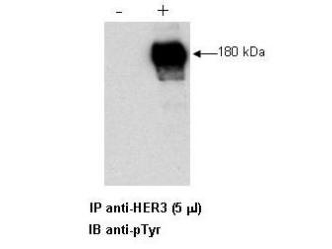ERBB3 / HER3 Antibody - Anti-HER3 Antibody - Immunoprecipitation/Western Blot. Combined immunoprecipitation and western blot of a human cell lysate using anti-HER3 antibody. Lysates were prepared from a human LNCap prostate cell line both with (+) treatment with Heregulin-b1 for 15 at 100 ng/ml and without (-) the addition of Heregulin-b1. The combination of immunoprecipitation and western blotting was performing using 5 ul of the anti-HER3 antibody for immunoprecipitation followed by western blot detection using an anti-phosphotyrosine antibody. Visualization occurred using an ECL system. Film exposure approximately 1. Other detection systems will yield similar results.