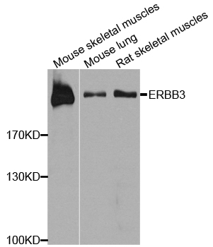 ERBB3 / HER3 Antibody - Western blot analysis of extracts of various cell lines, using ERBB3 antibody at 1:1000 dilution. The secondary antibody used was an HRP Goat Anti-Rabbit IgG (H+L) at 1:10000 dilution. Lysates were loaded 25ug per lane and 3% nonfat dry milk in TBST was used for blocking. An ECL Kit was used for detection and the exposure time was 90s.
