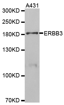 ERBB3 / HER3 Antibody - Western blot analysis of extracts of A431 cells.