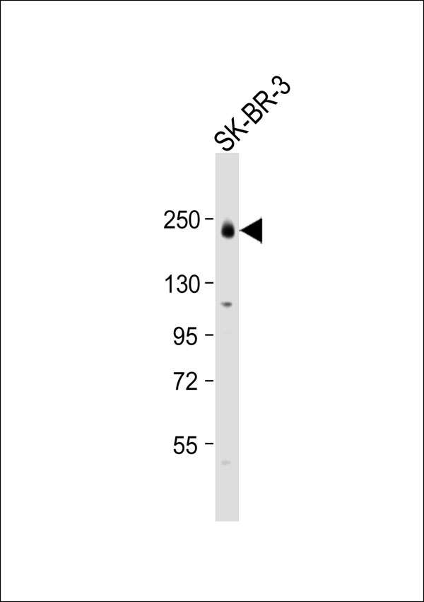 ERBB3 / HER3 Antibody - Anti-HER3 (pY1222) Antibody at 1:1000 dilution + SK-BR-3 whole cell lysate Lysates/proteins at 20 ug per lane. Secondary Goat Anti-Rabbit IgG, (H+L), Peroxidase conjugated at 1:10000 dilution. Predicted band size: 148 kDa. Blocking/Dilution buffer: 5% NFDM/TBST.