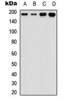 ERBB3 / HER3 Antibody - Western blot analysis of HER3 expression in K562 (A); NIH3T3 (B); mouse heart (C); mouse brain (D) whole cell lysates.