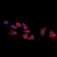 ERBB3 / HER3 Antibody - Immunofluorescent analysis of HER3 staining in HeLa cells. Formalin-fixed cells were permeabilized with 0.1% Triton X-100 in TBS for 5-10 minutes and blocked with 3% BSA-PBS for 30 minutes at room temperature. Cells were probed with the primary antibody in 3% BSA-PBS and incubated overnight at 4 deg C in a humidified chamber. Cells were washed with PBST and incubated with a DyLight 594-conjugated secondary antibody (red) in PBS at room temperature in the dark. DAPI was used to stain the cell nuclei (blue).