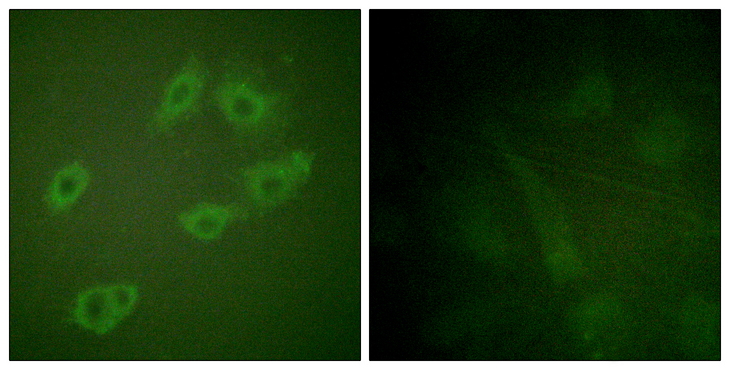 ERBB3 / HER3 Antibody - Immunofluorescence analysis of HUVEC cells, using HER3 (Phospho-Tyr1222) Antibody. The picture on the right is blocked with the phospho peptide.