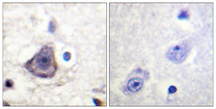 ERBB3 / HER3 Antibody - Immunohistochemistry analysis of paraffin-embedded human brain, using HER3 (Phospho-Tyr1222) Antibody. The picture on the right is blocked with the phospho peptide.