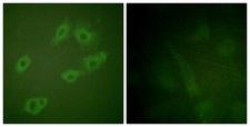 ERBB3 / HER3 Antibody - P-peptide - + Immunofluorescence analysis of HuvEc cells, using HER3/ErbB3 (Phospho-Tyr1222) antibody.