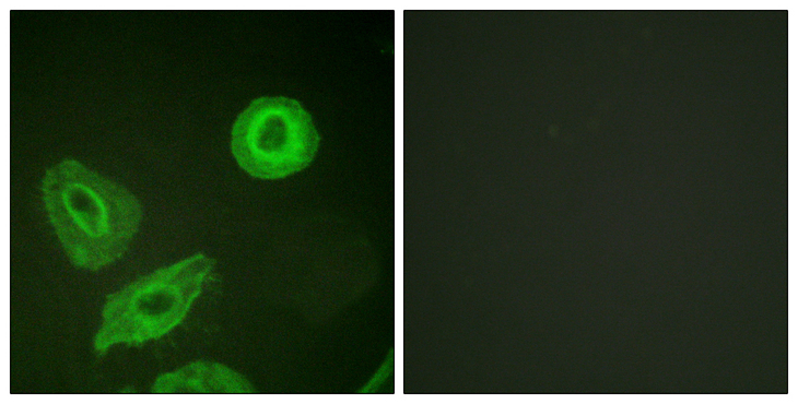 ERBB3 / HER3 Antibody - Immunofluorescence analysis of HeLa cells, using HER3 (Phospho-Tyr1289) Antibody. The picture on the right is blocked with the phospho peptide.