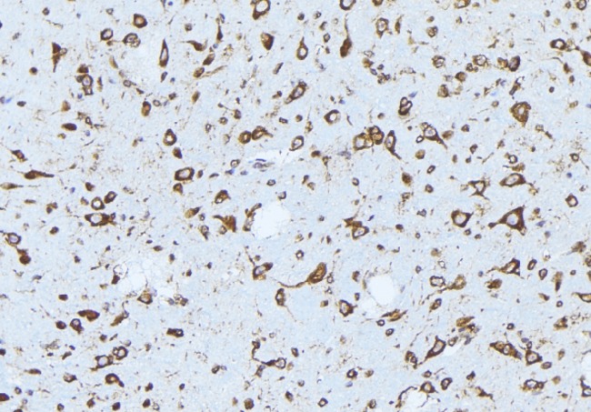 ERBB3 / HER3 Antibody - 1:100 staining mouse brain tissue by IHC-P. The sample was formaldehyde fixed and a heat mediated antigen retrieval step in citrate buffer was performed. The sample was then blocked and incubated with the antibody for 1.5 hours at 22°C. An HRP conjugated goat anti-rabbit antibody was used as the secondary.
