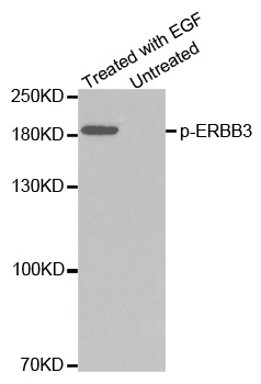 ERBB3 / HER3 Antibody - Western blot analysis of extracts from A431 cells.
