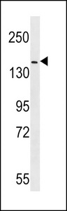 ERBB4 / HER4 Antibody - HER4 Antibody (pY1162) western blot of mouse NIH-3T3 cell line lysates (35 ug/lane). The HER4 antibody detected the HER4 protein (arrow).