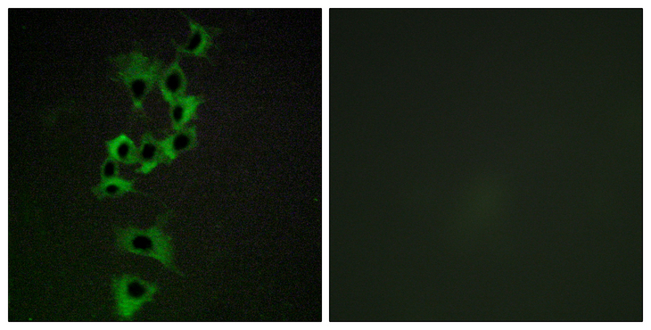 ERBB4 / HER4 Antibody - Immunofluorescence analysis of HepG2 cells, using HER4 Antibody. The picture on the right is blocked with the synthesized peptide.