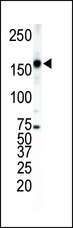 ERBB4 / HER4 Antibody - Western blot of anti-ErbB4 antibody in T-47D cell lysate. ErbB4 (arrow) was detected using purified antibody. Secondary HRP-anti-rabbit was used for signal visualization with chemiluminescence.