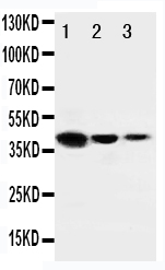 ERBB4 / HER4 Antibody - WB of ERBB4 / HER4 antibody. Recombinant Protein Detection Source:. E.coli derived -recombinant human ERRB4, 40.6KD. (162aa tag+M1-P200). All lanes: Anti-ERBB4 at 0.5ug/ml. Lane 1: Recombinant Human ERRB4 Protein 10ng. Lane 2: Recombinant Human ERRB4 Protein 5ng. Lane 3: Recombinant Human ERRB4 Protein 2.5ng. Predicted bind size: 41KD. Observed bind size: 41KD.