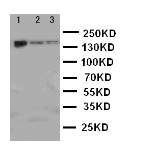 ERBB4 / HER4 Antibody - WB of ERBB4 / HER4 antibody. Lane 1: HELA Cell Lysate. Lane 2: U87 Cell Lysate. Lane 3: NEURO Cell Lysate..
