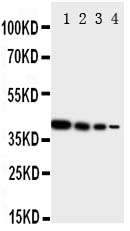 ERBB4 / HER4 Antibody - Anti-ErbB 4 antibody, Western blottingRecombinant Protein Detection Source: E. coli derived -recombinant human ERRB4, 40.6KD (162aa tag+M1-P200)Lane 1: Recombinant Human ERRB4 Protein 10ng Lane 2: Recombinant Human ERRB4 Protein 5ng Lane 3: Recombinant Human ERRB4 Protein 2. 5ng Lane 4: Recombinant Human ERRB4 Protein 1. 25ng