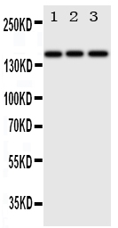 ERBB4 / HER4 Antibody - Anti-ErbB 4 antibody, Western blotting Lane 1: HELA Cell LysateLane 2: U87 Cell LysateLane 3: NEURO Cell Lysate