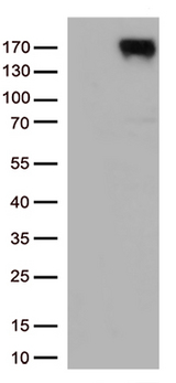 ERBB4 / HER4 Antibody - HEK293T cells were transfected with the pCMV6-ENTRY control. (Left lane) or pCMV6-ENTRY ERBB4. (Right lane) cDNA for 48 hrs and lysed. Equivalent amounts of cell lysates. (5 ug per lane) were separated by SDS-PAGE and immunoblotted with anti-ERBB4.