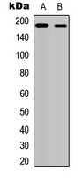ERBB4 / HER4 Antibody - Western blot analysis of HER4 expression in Y79 (A); MOLT4 (B) whole cell lysates.