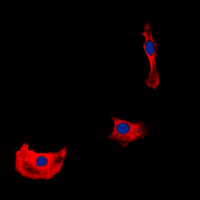ERBB4 / HER4 Antibody - Immunofluorescent analysis of HER4 staining in HepG2 cells. Formalin-fixed cells were permeabilized with 0.1% Triton X-100 in TBS for 5-10 minutes and blocked with 3% BSA-PBS for 30 minutes at room temperature. Cells were probed with the primary antibody in 3% BSA-PBS and incubated overnight at 4 deg C in a humidified chamber. Cells were washed with PBST and incubated with a DyLight 594-conjugated secondary antibody (red) in PBS at room temperature in the dark. DAPI was used to stain the cell nuclei (blue).