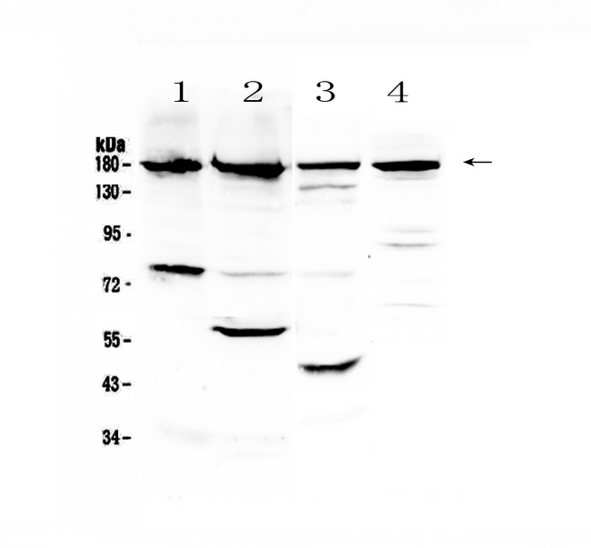 ERBB4 / HER4 Antibody - Western blot - Anti-ErbB 4 Picoband antibody