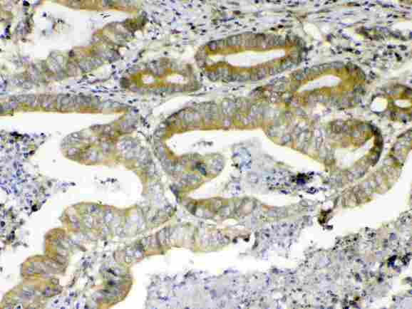 ERBB4 / HER4 Antibody - Immunohistochemistry - Anti-ErbB 4 Picoband antibody