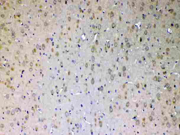 ERBB4 / HER4 Antibody - Immunohistochemistry - Anti-ErbB 4 Picoband antibody